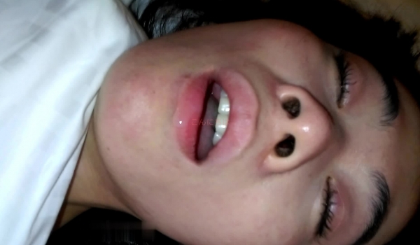 气质人妻在酒吧被带到酒店MJ，煳煳被操醒发出人的呻吟声，，内射操出血，睡觉打可爱唿噜，绝版