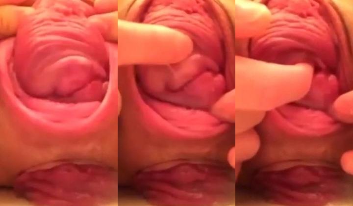 大开眼界啊 能把自己浪屄和菊花玩成这样也绝啦 前面是子宫脱垂后面是脱肛 是不是废了