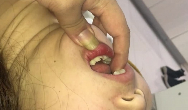 【MJ极品】价值1500RMB的年轻巨乳小妹下药失去意识任人玩弄啪啪 无套内射 两颗球球是真的大